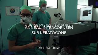 Anneau intracornéen pour kératocône chirurgie en direct 1520 Institute Dr Trinh [upl. by Naivaj]