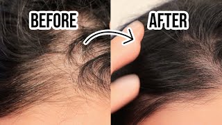 EASY DIY BEAUTY TIPS AND TRICKS  HOW TO COVER WHITE HAIR ROOTS [upl. by Garmaise280]