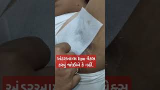 lipowaxટીપ્સRica axunderarms lipo waxઅન્ડઆમ્સલીપો કરવું જોઈએ કે ગુજરાતીગુજરાત Bharatviralshots [upl. by Bunce]