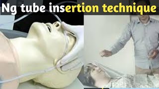 ng tube insertion procedure in hindi step by step Full Explain [upl. by Dudden]