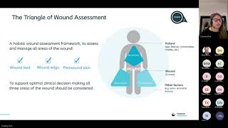 Leg Ulcers how to simplify and make life easier using Assess Prepare Treat [upl. by Mencher]