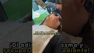 Tratamiento para Melasma melasma melasmatreatment laser [upl. by Dunton]