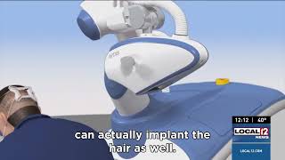 Introducing Artas Robot iXi The Future of Hair Transplants at Advanced Cosmetic Surgery [upl. by Moriarty]