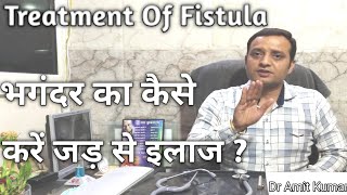 Fistula भगंदर बिना ऑपेरशन कैसे जड़ से ठीक करें भगंदर का इलाज कैसे करें  Treatment Of Fistula [upl. by Renick397]