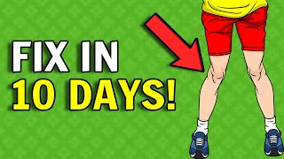 Best Exercises For Knock Knees Workout For Knock Knees With Stretching amp Exercise [upl. by Budding]