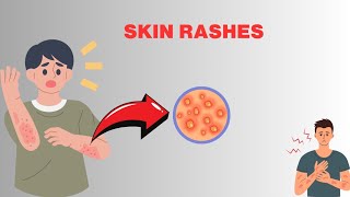 Skin rashescauses  diagnosis symptoms treatment [upl. by Conley]