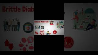 Brittle Diabetes Symptoms and Causes  Diagnosis  Treatment  Prevention disease healthcare [upl. by Odrareve]