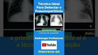 Técnica Ideal Para Detectar o Pneumoperitônio shorts tecnologoemradiologia amigosdaradiologia [upl. by Cyrillus]