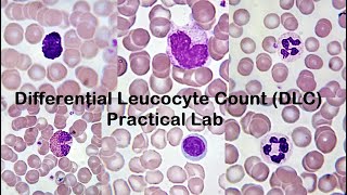 Differential Leucocyte Count DLC Practical Lab [upl. by Lleddaw]