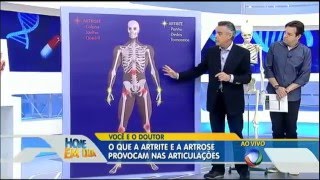 Artrite e artrose saiba como prevenir e tratar no Você e o Doutor [upl. by Aineg]