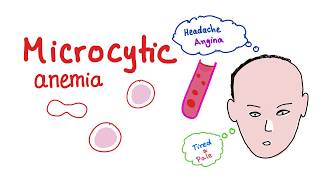 Microcytic Anemia introduction [upl. by Meredi]