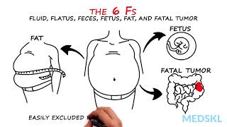 Abdominal Distension The 6 Fs that can help your diagnosis [upl. by Butcher]