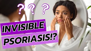 Psoriasis The Hidden Suffering You Never Knew About [upl. by Banna]