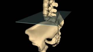 Posterior Innominate Rotation [upl. by Quincey]