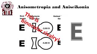 Anisometropia Definitions [upl. by Luisa]