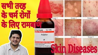 Sulphur Mother Tincture ko kaun kaun si skin disease चर्म रोग में use Karen aur kaise use Karen [upl. by Anyk]