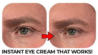 THE INSTANT EYE CREAM THAT WORKS IMMEDIATELY [upl. by Aiciram]