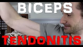 How Biceps Tendonitis Happens [upl. by Bethesde]