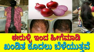 How to grow Hair in Kannada  grow hair from onion  ಈರುಳ್ಳಿ ಇಂದ ಹೀಗೆಮಾಡಿ ಖಂಡಿತ ಕೂದಲು ಬೆಳೆಯುತೆ [upl. by Wandie]