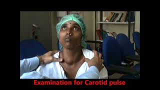 clinical examination of Goitre Thyroid examination Thyrotoxicosis [upl. by Bolger838]