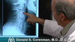 How to Read Xrays of the Cervical Spine Neck  Colorado Spine Expert [upl. by Kolivas]