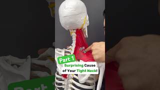 Part 12 Is your neck tight with shoulder blade or arm pain Try this neckpain shoulderpain tmj [upl. by Tnomal]