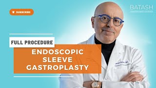 Endoscopic Sleeve Gastroplasty ESG Procedure  Full Procedure Video [upl. by Virnelli]