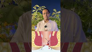 Perineal Fistula  Fistula  Surgeon  CT  Ultrasound doctor drneelabh drneelabhagrawal yt [upl. by Ralph679]