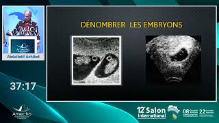 Echographie du 1er trimestre objectifs et dernières recommandations de la cneof abdellatif achi [upl. by Meekah]