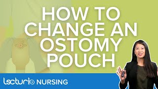 How To Change An Ostomy Pouch  Explanation amp Demonstration  Lecturio Nursing [upl. by Rehtul]