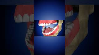 Dental Implant dentalhealth dentalcare teeth [upl. by Mahla303]