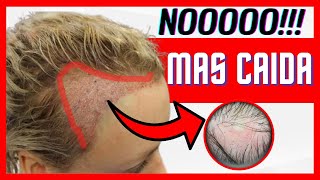 ✅ DOCTOR te cuenta 🛑 PEINADOS que producen CAIDA DE CABELLO [upl. by Ekez344]