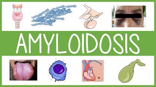 Understanding Amyloidosis [upl. by Weslee]