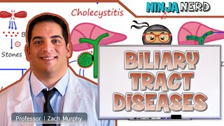 Biliary Tract Diseases  Clinical Medicine [upl. by Annodam]