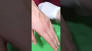 How to Insert IV Cannula  IV Cannulation Technique  Branula  Intravenous Catheter [upl. by Durst724]