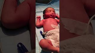 New born baby just after birth vairal trending shorts drriteshkumarofficial🤣🤣🤣🙏🙏🙏 [upl. by Annairda712]