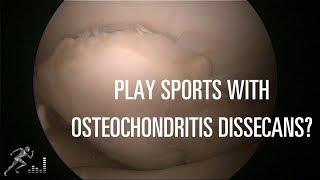 Should you play sports with an OCD lesion in your knee [upl. by Anitsirt461]