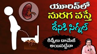 Dr Movva Srinivas  యూరిన్ లో నురగ వచ్చేవారికి హెచ్చరిక Unknown Facts Urine  Foamy Urine Kidney [upl. by Hameean]