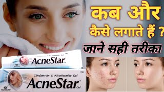 Acnestar gel cream review in Hindi  Best for acne pimple cream  How to use acnestar cream benefit [upl. by Shaughnessy554]