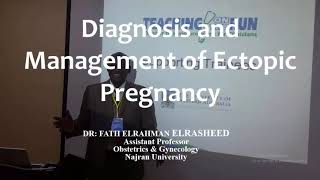 RCOG Guidelines Diagnosis and Managment of Ectopic Pregnancy [upl. by Bamberger]