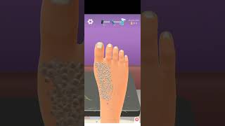 Asmr Treatment Foot Careasmr youtubeshorts viralvideo gaming [upl. by Alim836]