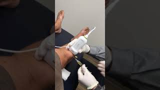 Prepatellar Bursa Aspiration  Elite Sports Medicine  Lethbridge [upl. by Grindle]