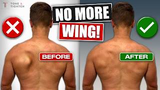 Fix Scapular Winging FOR GOOD Shoulder Blade Exercises [upl. by Iffar]