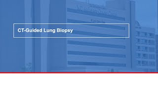 CTguided lung biopsy [upl. by Eckhardt]