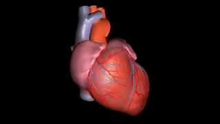 Ventricular TachycardiaVentricular Fibrillation and ICDImplantable Cardioverter Defibrillator [upl. by Gresham]