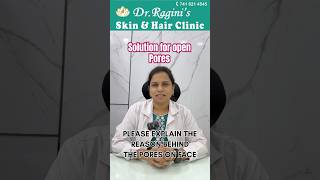 Best Treatments for Acne Scars  Dr Ragini Skin amp Hair Clinic [upl. by Annenn567]