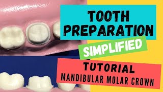 Zirconia Crown Preparation DEMONSTRATION Super Simplified [upl. by Eytak286]