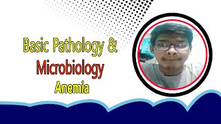 Basic Pathology amp Microbiology Anemia bengali lecture।Anemia  Define Causes Symptoms amp Treatments [upl. by Thury]