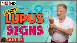 10 Lupus Disease Symptoms and Causes [upl. by Ayekam]