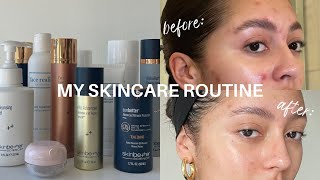 My Morning amp Night Skincare Routine  Cystic Hormonal Acne  Sloan Byrd [upl. by Adnilak]